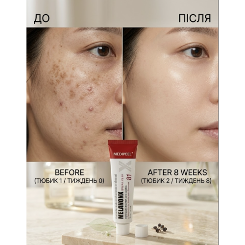 Крем освітлюючий проти пігментації MEDIPEEL Melanon X Cream  2.0  30 ml