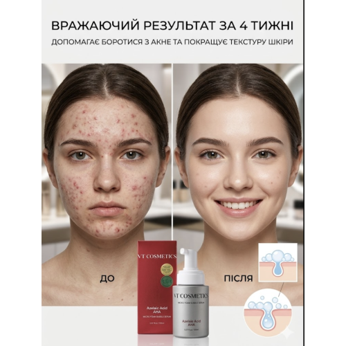 Сироватка мікропінна з азелаїновою і  AHA,BHA,PHA-кислотами VT AZ AHA RED MICRO BUBBLE SERUM 70 ml