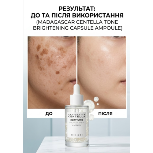 Ампула для обличчя освітлювальна SKIN1004 Madagascar Centella Tone Brightening Capsule Ampoule 30 мл (8809576261417)